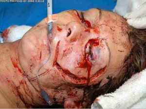 Anne Hjelle attach from Mountain Lion